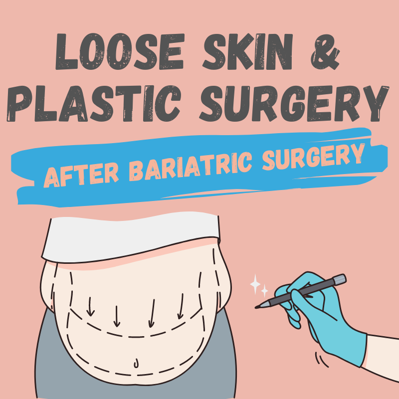 Plastic Surgery For Loose Skin After Bariatric Surgery