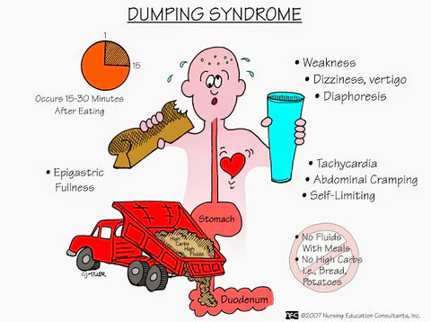 How to Survive Dumping Syndrome After Bariatric Surgery