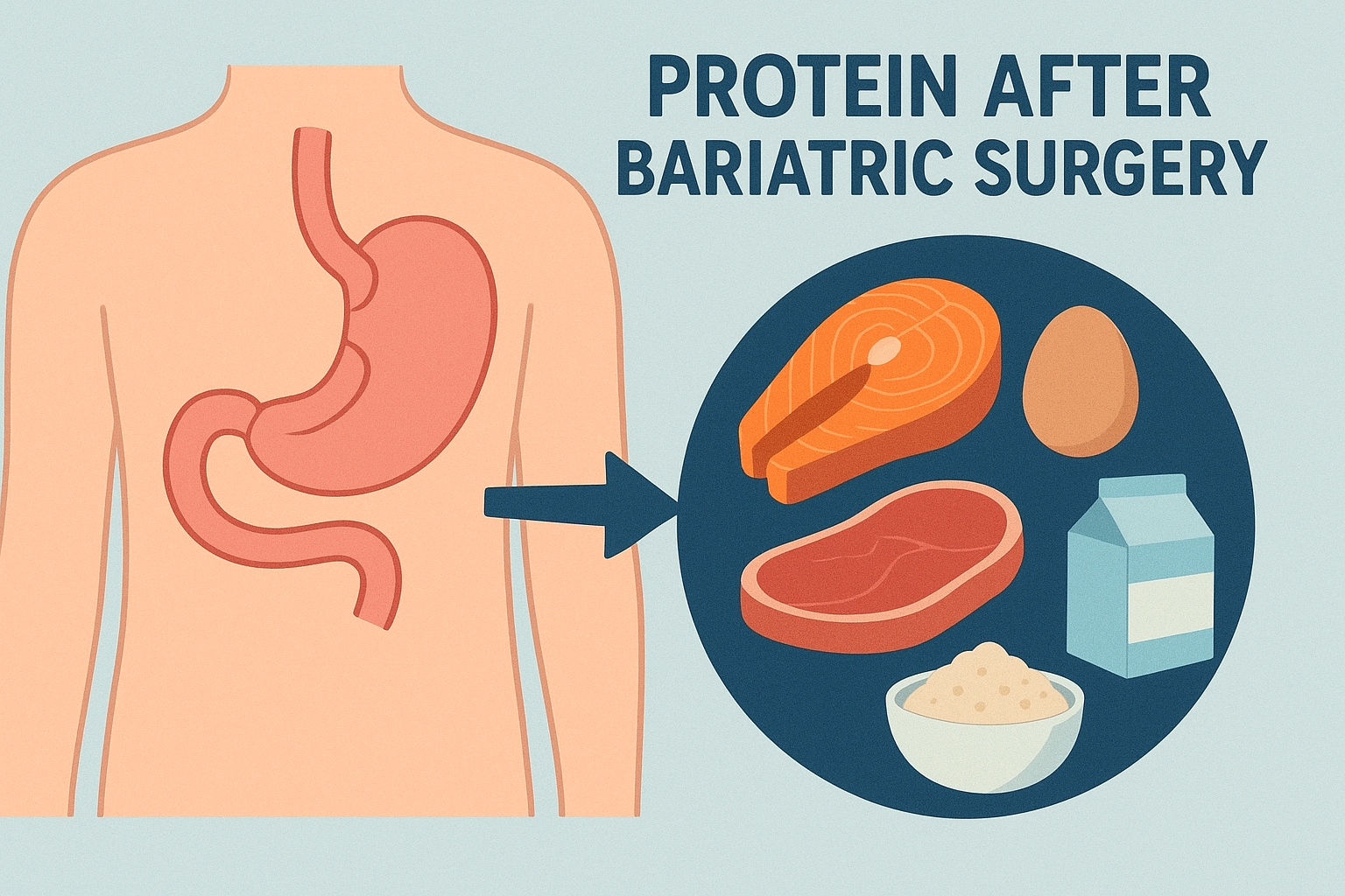 Why Do We Need Protein After Bariatric Surgery